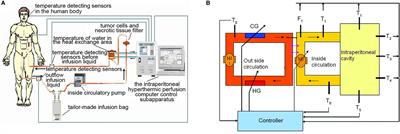 Safety and Effectiveness of High-Precision Hyperthermic Intraperitoneal Perfusion Chemotherapy in Peritoneal Carcinomatosis: A Real-World Study